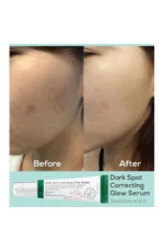 Axis-Y Dark Spot Correcting Glow Serum 5ml - Image 2