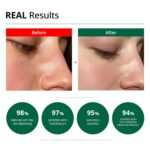 Doctor.G Red Blemish Clear Soothing Cream, 70ml - Image 3