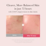 Medicube Txa Niacinamide 15% Serum 30ml - Image 4
