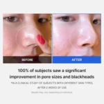 Medicube ZERO PORE PAD 2.0 (70pcs) - Image 4