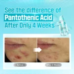 Numbuzin No.1 Pantothenic B5 Active Soothing Serum 50 ML - Image 3