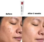 W.SKIN LAB_A.M (Anti-Melasma) Cream 50ml - Image 2