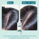 Wishcare AHA BHA Anti-Dandruff Shampoo Hydrating Formula – 250ml - Image 3