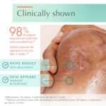 Avene Cicalfate+ Scar Gel 30ml