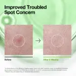 ANUA AZELAIC ACID 3 CICA SKIN CLARIFYING TONER 250ml